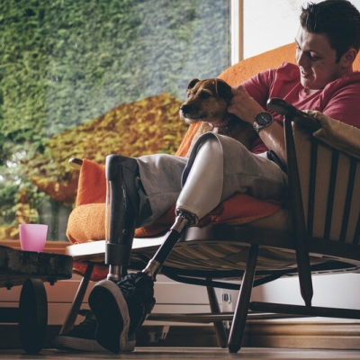 A young man is sitting in an armchair patting a dog. He is wearing prosthetic lower legs.